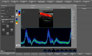 Farb-Doppler-Imaging