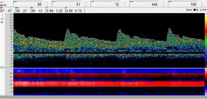 Routine diagnostics