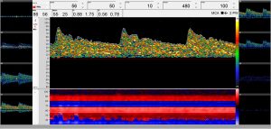 Routine diagnostics with 9 spectra windows