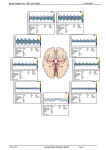 Standard report transcranial (extract)