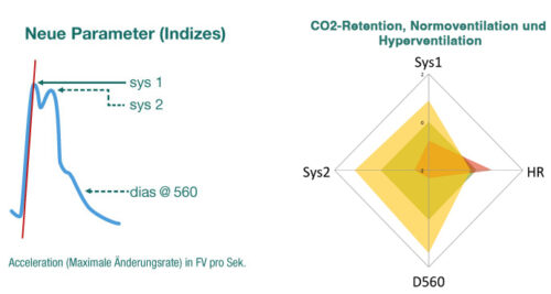 Neuromonitoring Analyse (NMA): Neue Parameter, CO2-Retention, Normoventilation und Hyperventilation