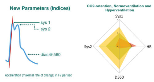 Neuromonitoring Analyse (NMA): New Parameter, CO2-retention, Normoventilation and Hyperventilation