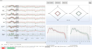 Monitoring-NMA: Man 54 years, normal conditions.