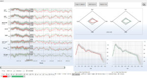 Monitoring – NMA: Woman, 20 years, normal conditions.